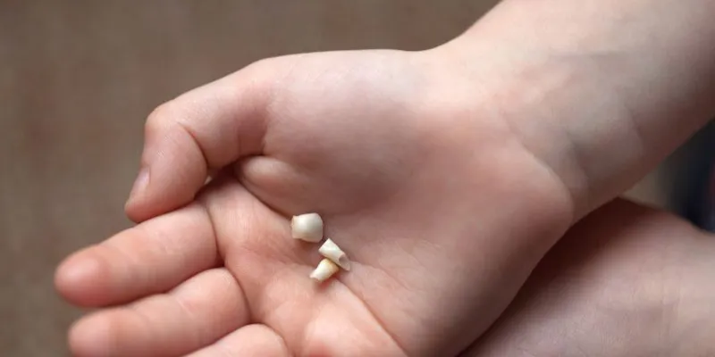 Ý nghĩa ẩn chứa đằng sau giấc mơ thấy rụng răng